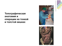 Презентация Топографическая анатомия и операции на тонкой и толстой кишках