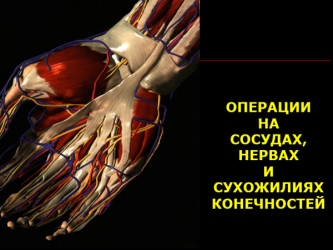 Презентация Операции на сосудах, нервах и сухожилиях конечностей