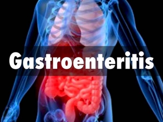 Гастроэнтерит - симптомы и признаки