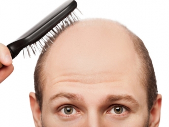 Выпадение волос - симптомы и признаки